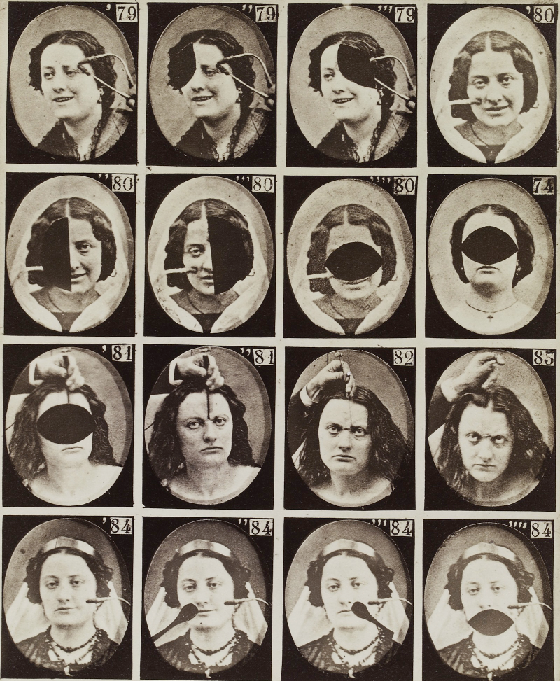 Illustration for article titled Terrifying, Century-Old Photographs from Neuroscience Experiments